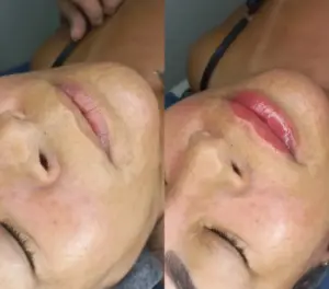 Micropigmentação Labial